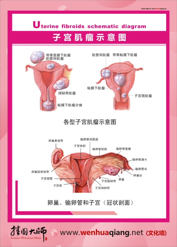 人體結(jié)構(gòu)解剖圖   人體結(jié)構(gòu)圖   人體結(jié)構(gòu)示意圖   子宮肌瘤示意圖     